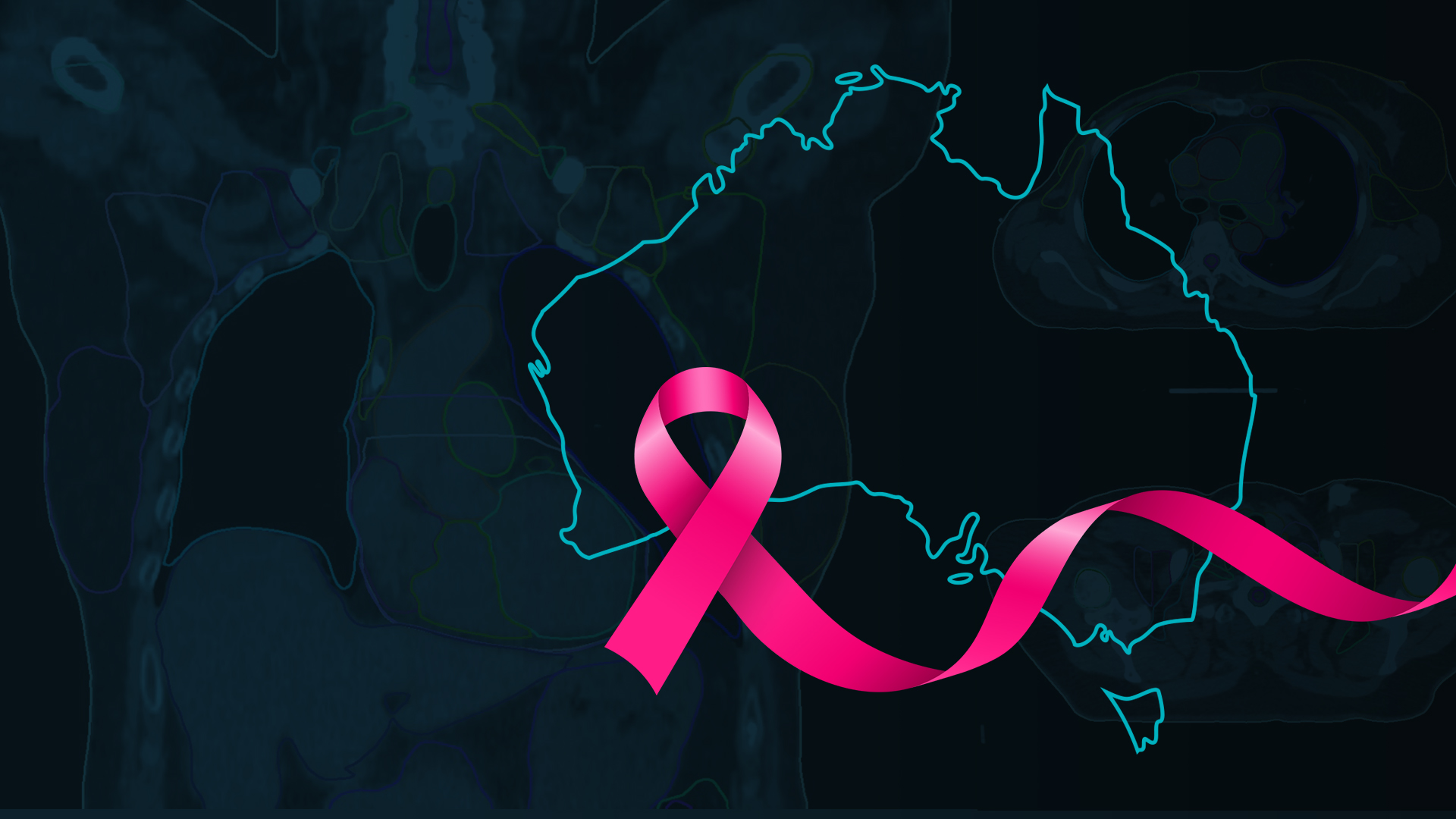 Cancer in Australia – Rising Cases, But Better