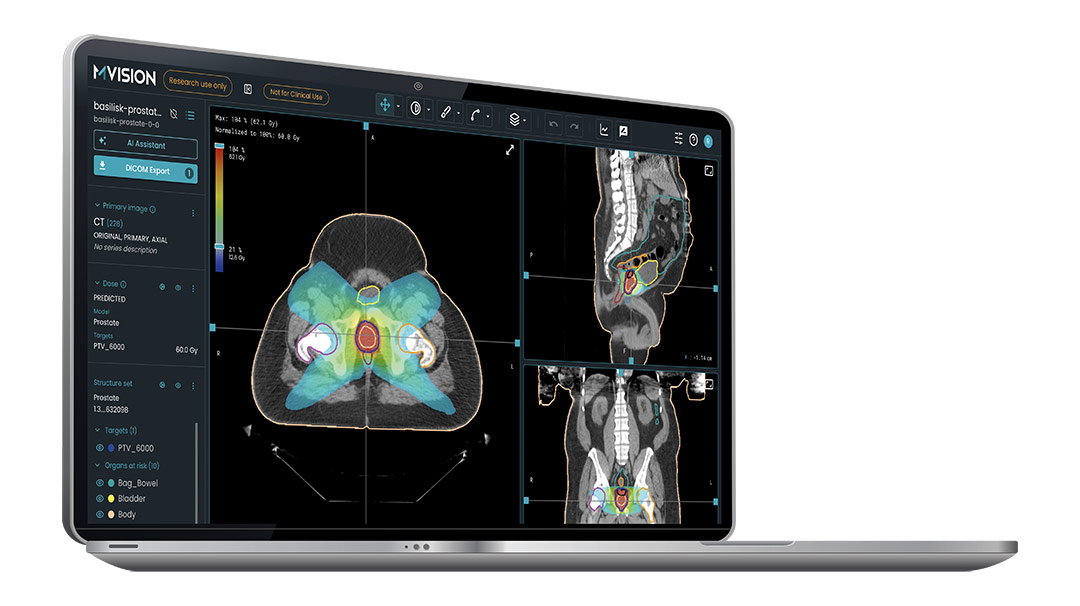 MVision AI s Dose Receives FDA 510 k Clearance For Clinical Use In 