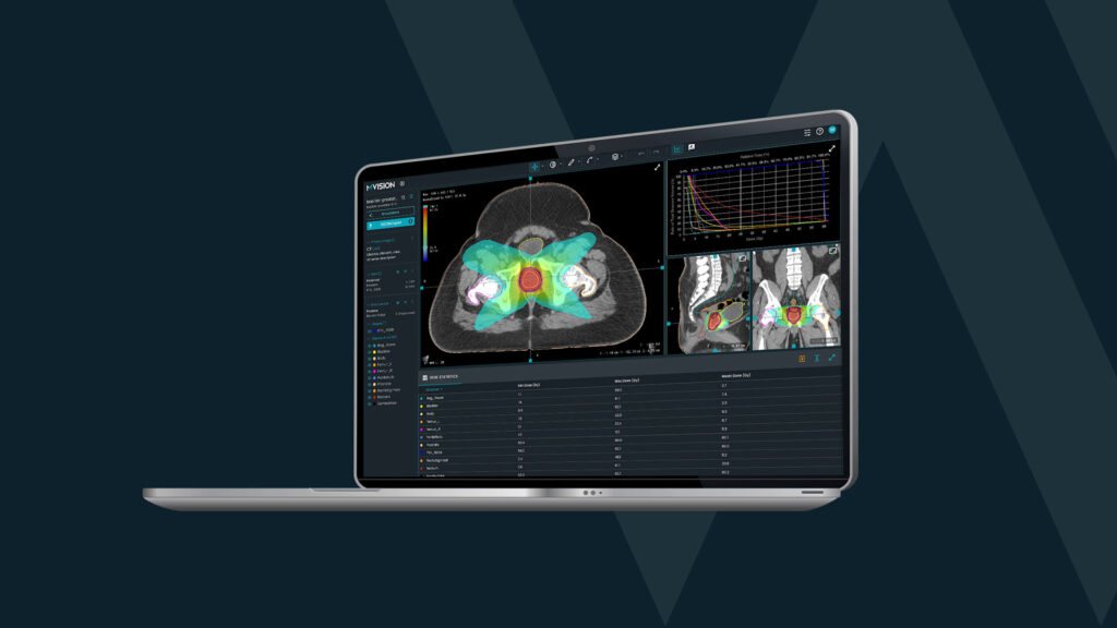 Computer screen showing contours