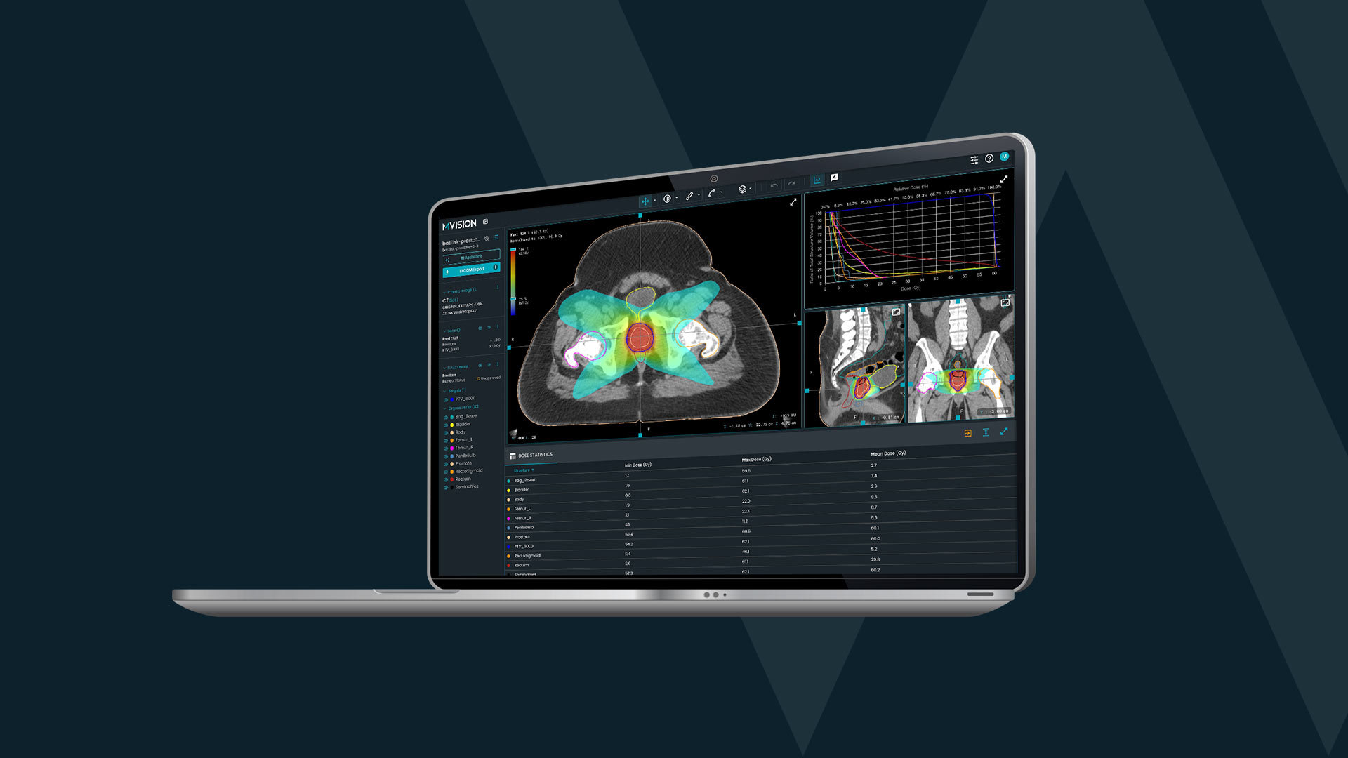 Computer screen showing contours