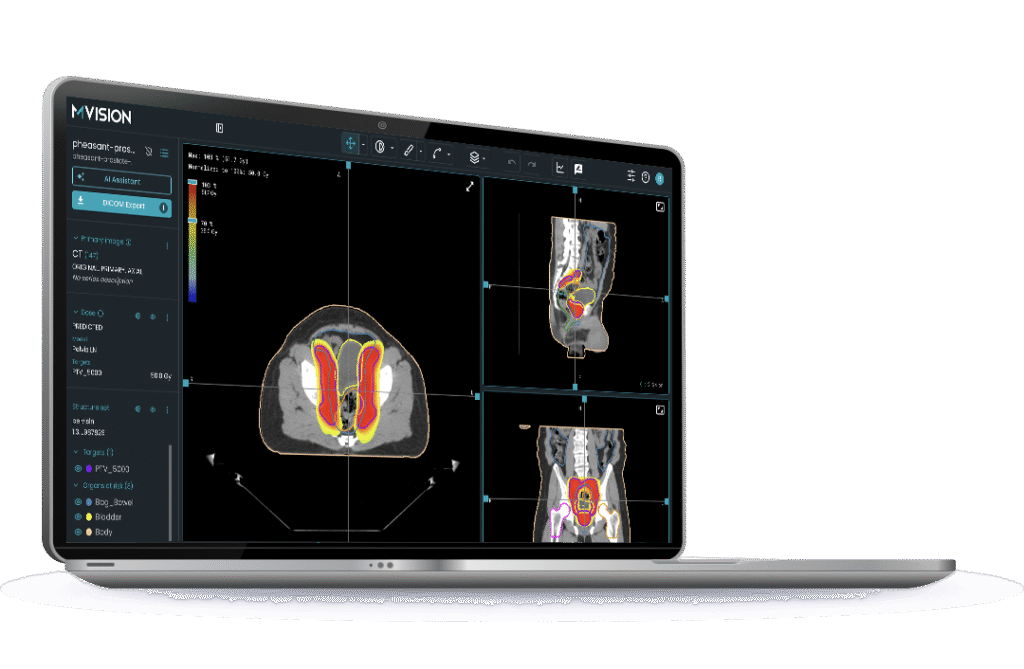 Workspace Intelligent AI PlatformFor Radiotherapy MVision AI