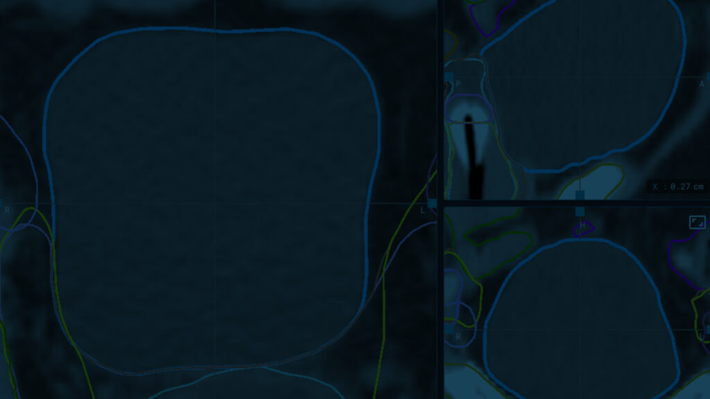 An image of a contour with a dark foreground
