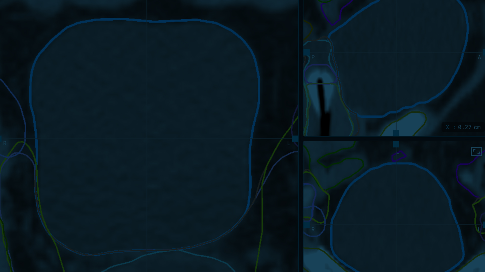 An image of a contour with a dark foreground