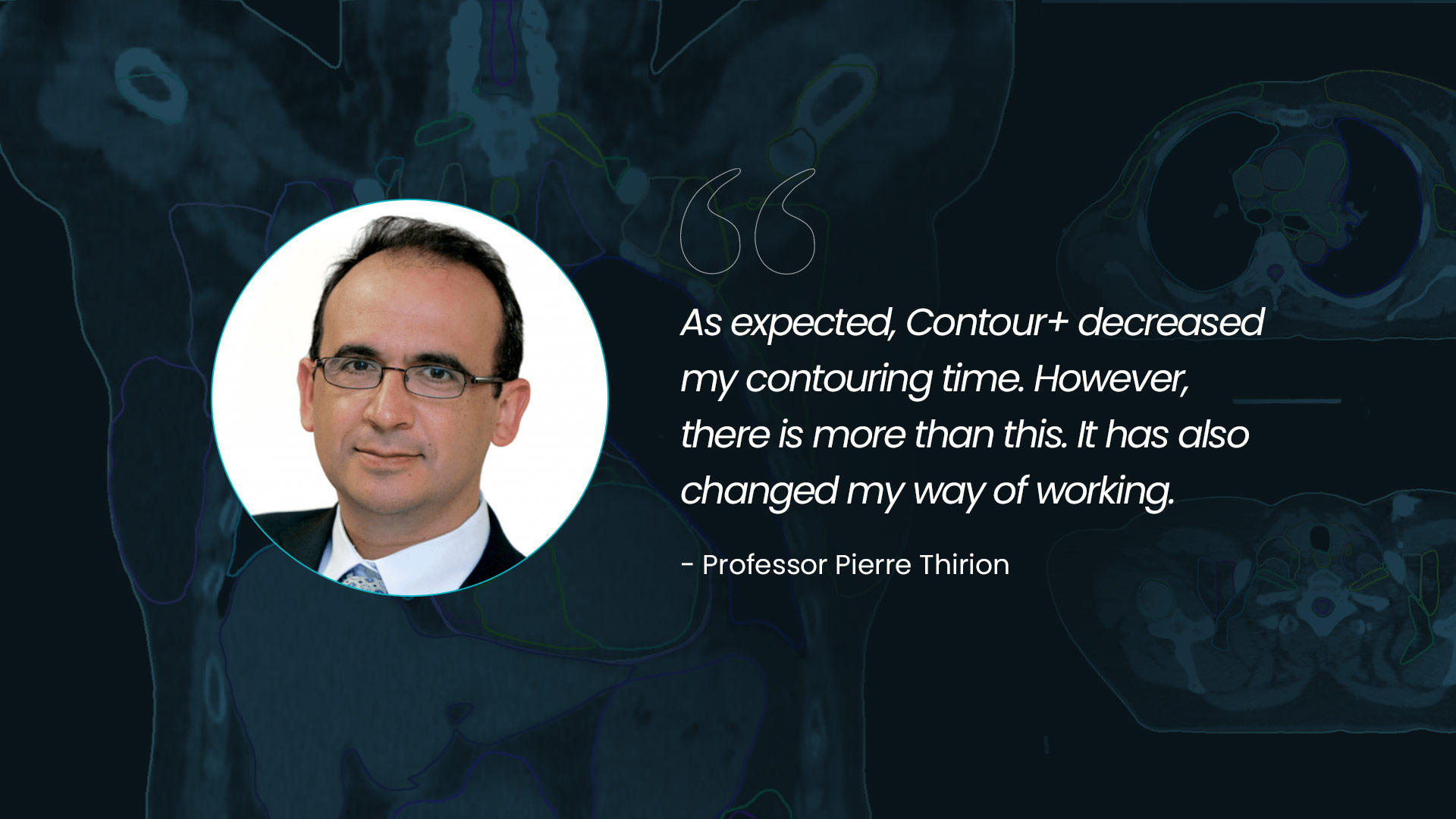 The Promise of AI in Radiation Oncology