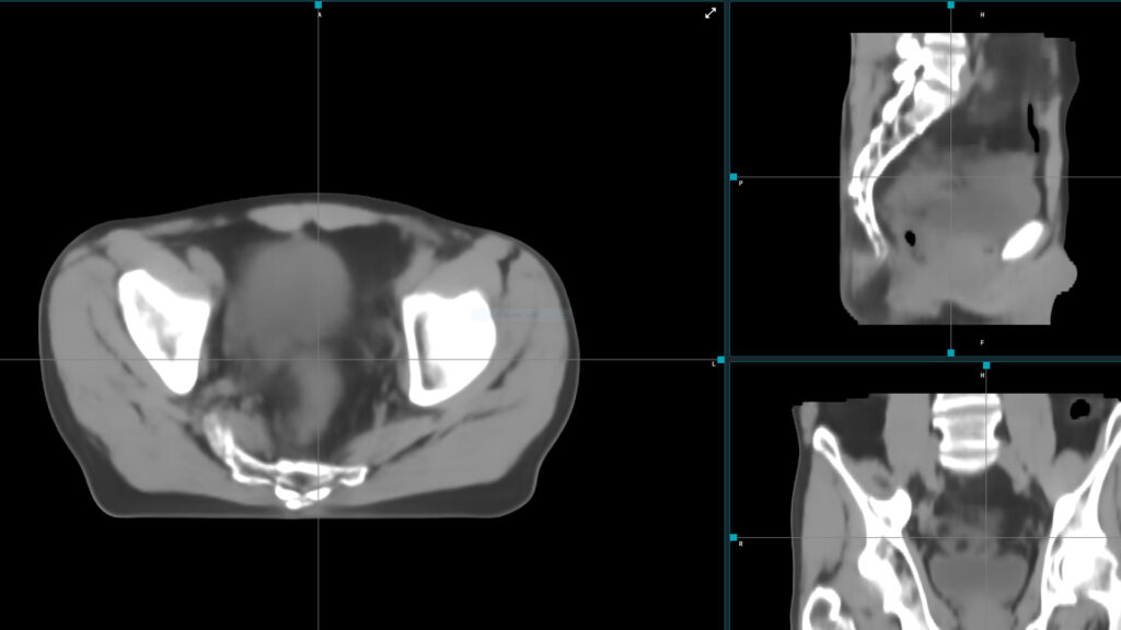 Image+ on a computer screen