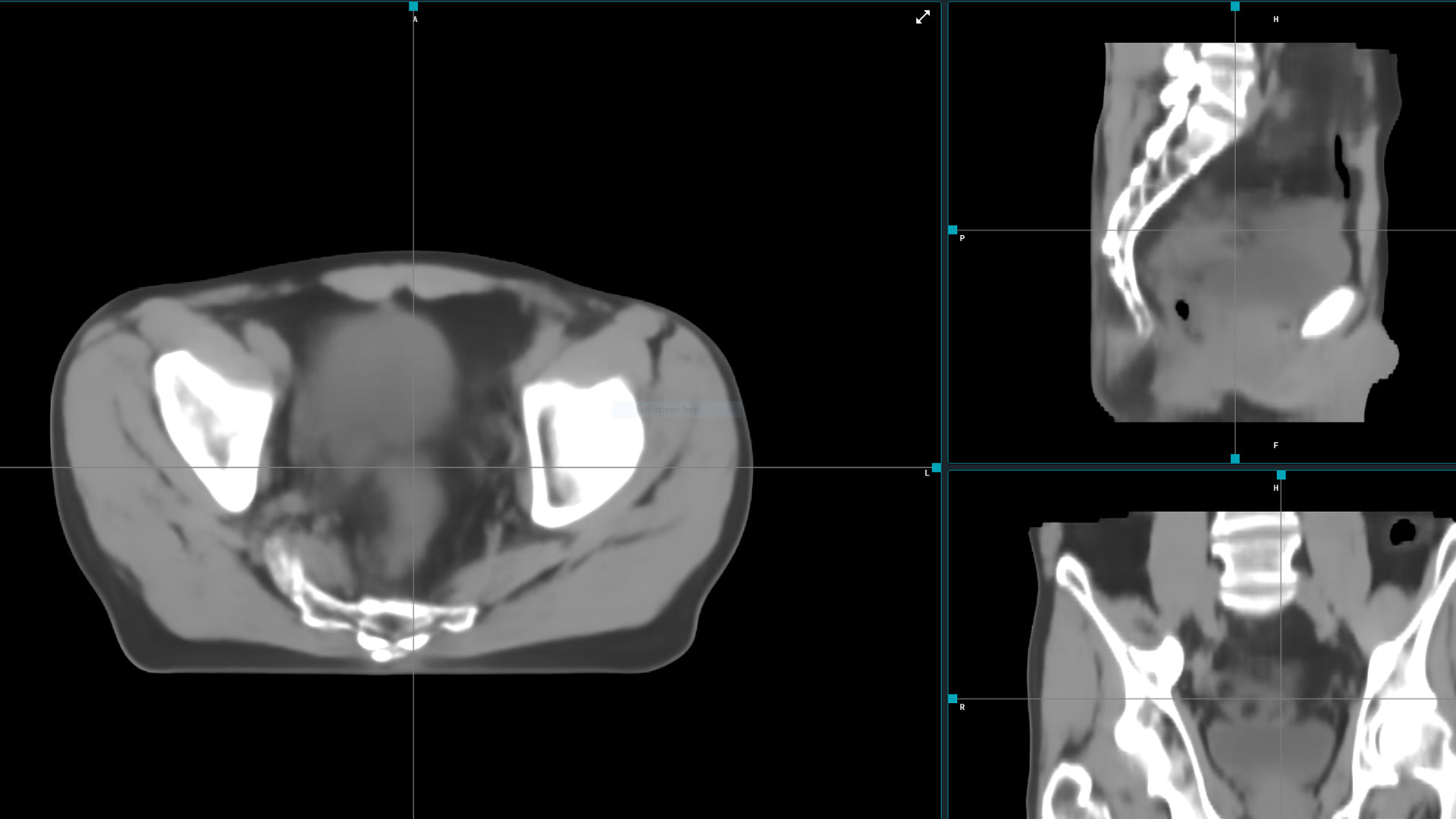 Image+ on a computer screen