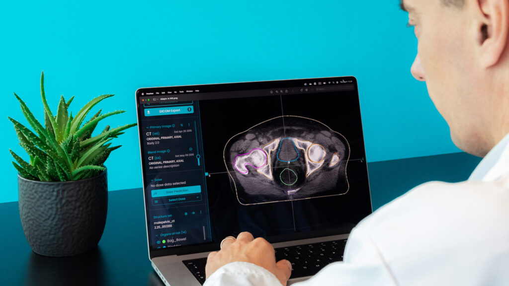 Comparative algorithm testing in Sweden for thorax organs at risk