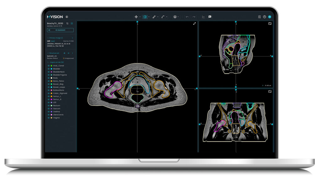 Workspace+: Contour+