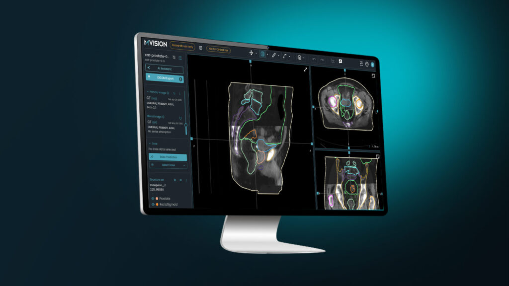Monitor of contoured images