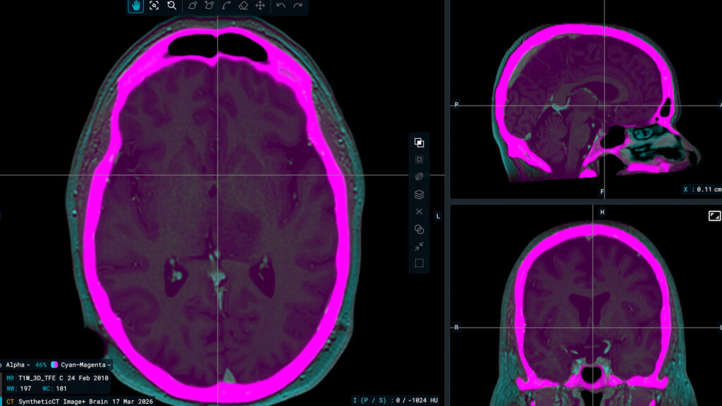 Image+ — Synthetic Imaging for Radiotherapy Workflows