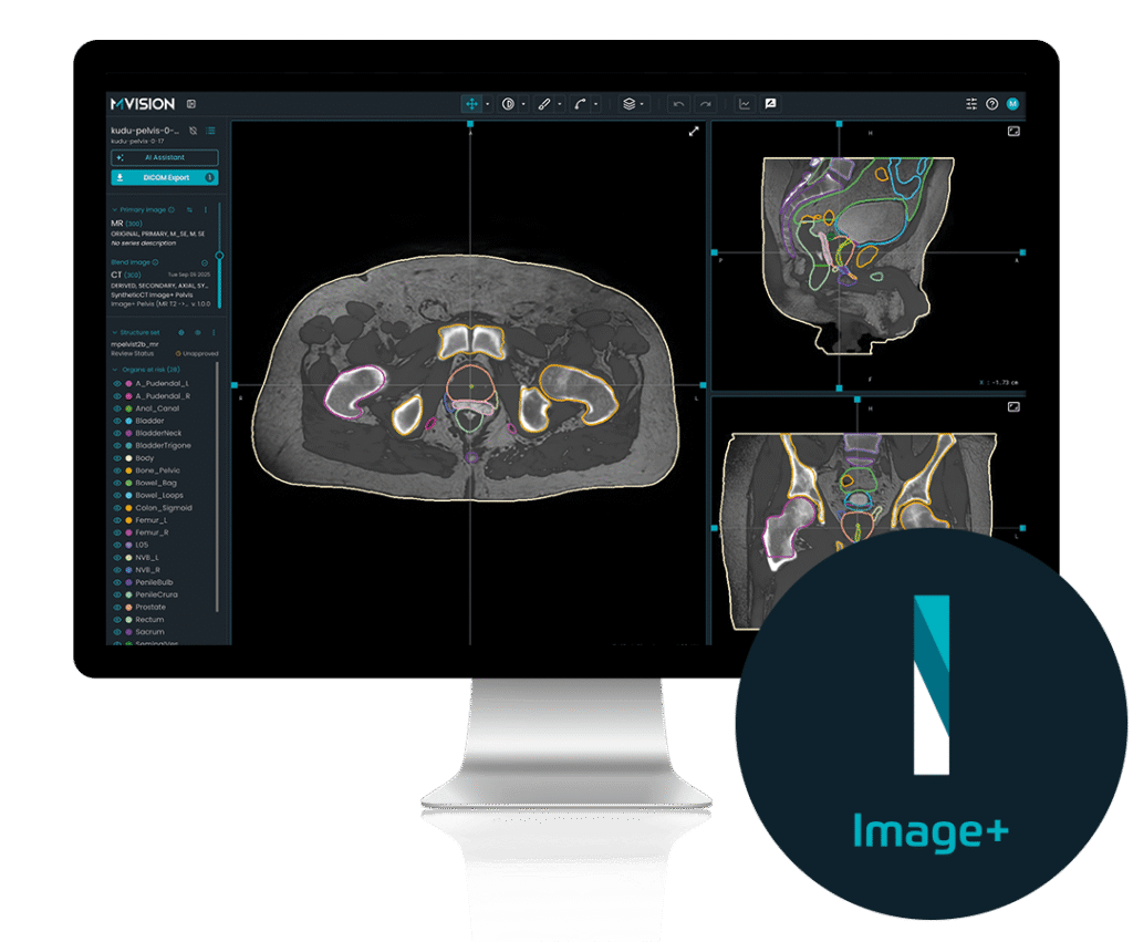 Image+ | Powering Radiotherapy With Synthetic Imaging | MVision AI