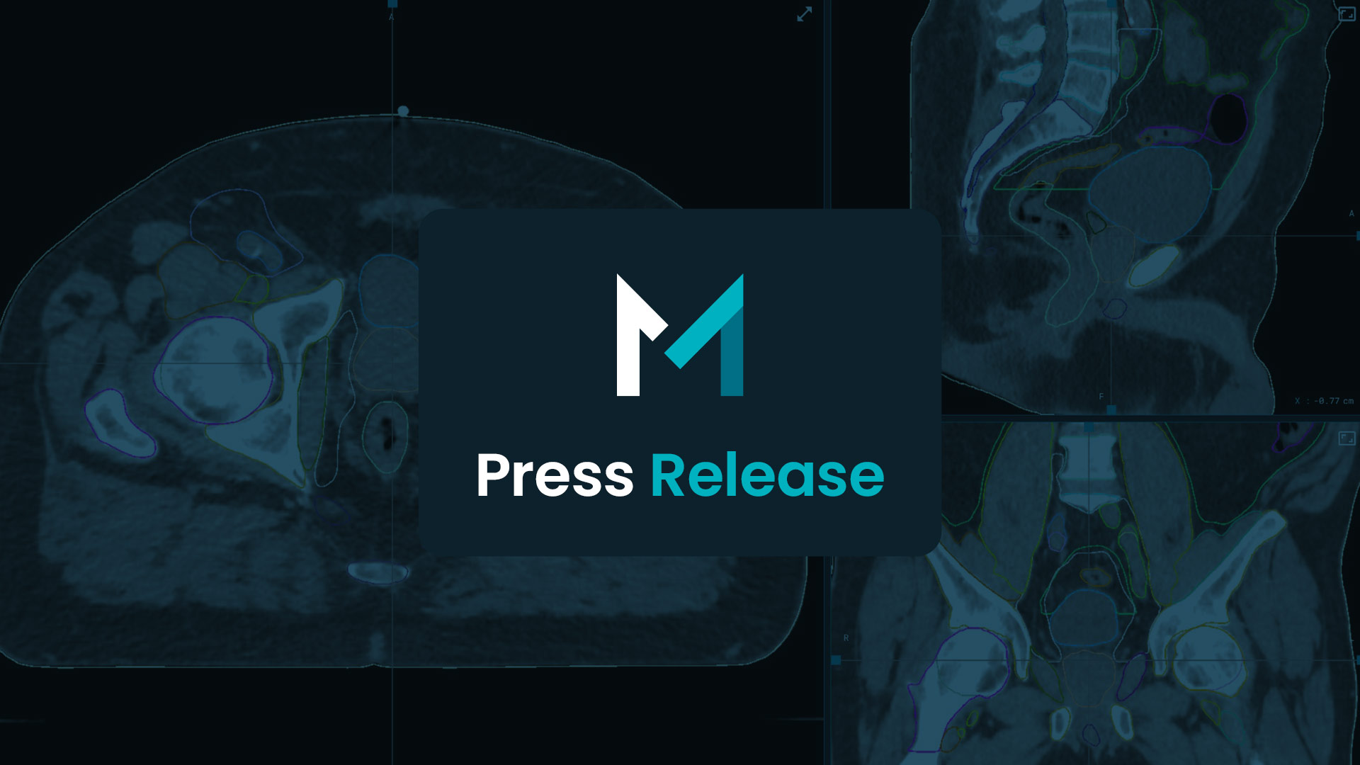 Press release