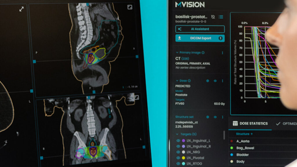 Profile of a radiation oncologist looking at a contoured image