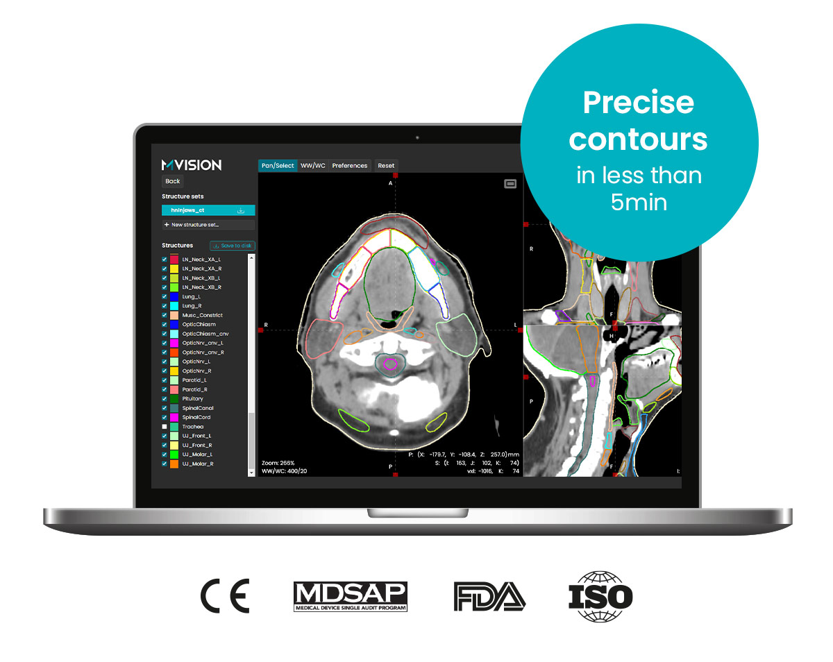 Guideline Based Segmentation MVision AI