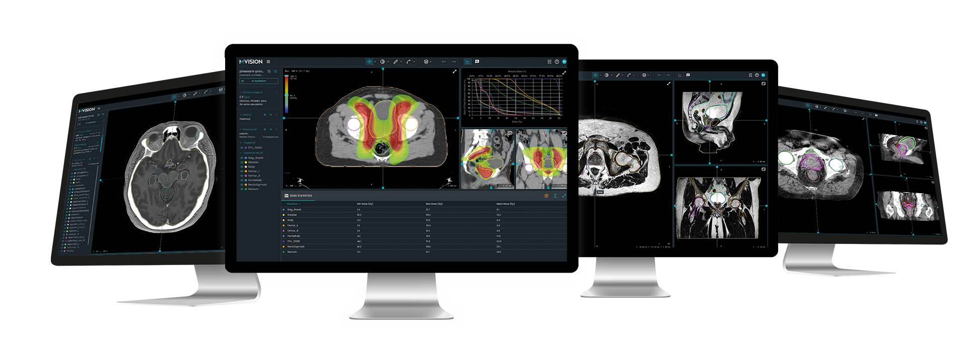 Workspace+ | Intelligent AI PlatformFor Radiotherapy | MVision AI